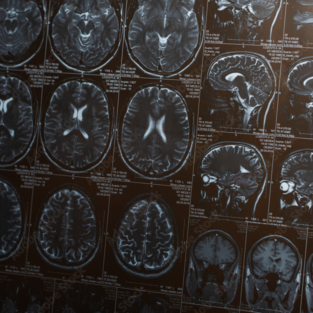 MRI